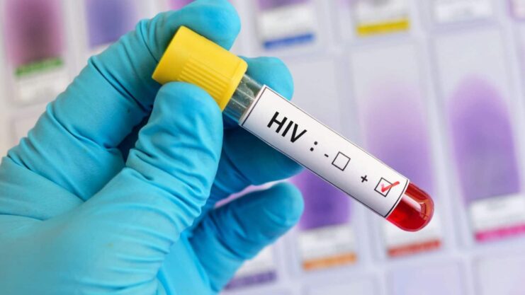 HIV Test