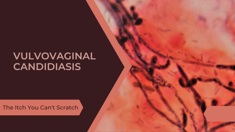 Vulvovaginal Candidiasis