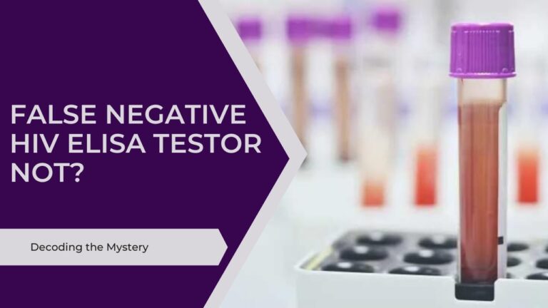 False Negative HIV ELISA Test