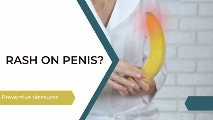 Get rid of the Rash on Penis - Preventive Measures and Treatment