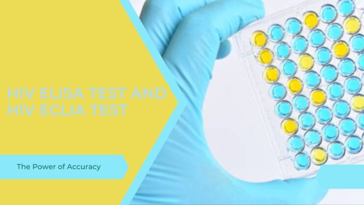 HIV ELISA Test And HIV ECLIA Test