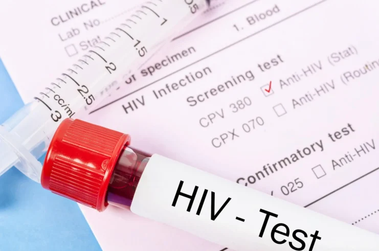 HIV - Test