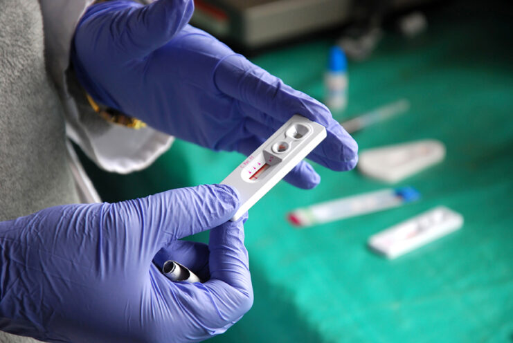 Hiv Anonymous Testing