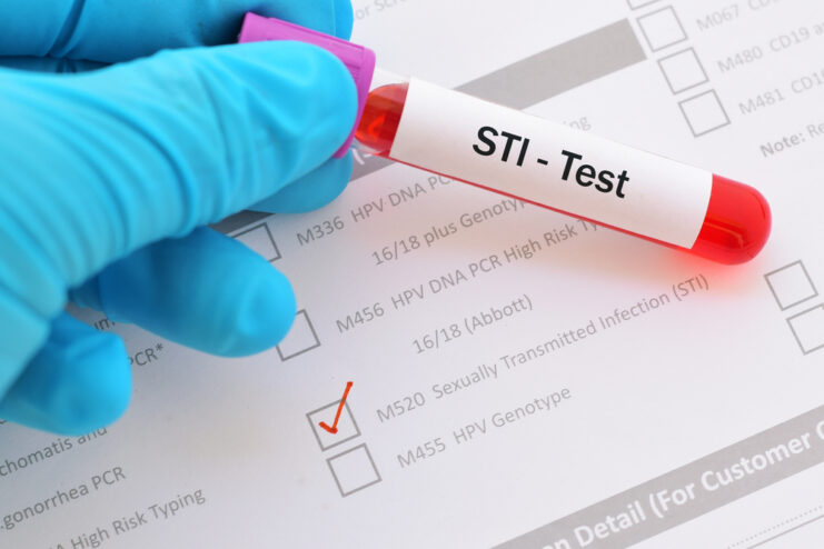 STI Diagnosis and Treatment