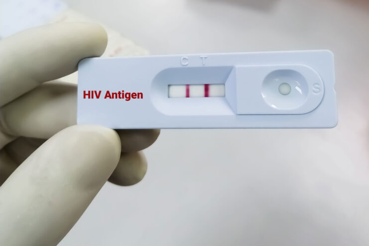 hiv test