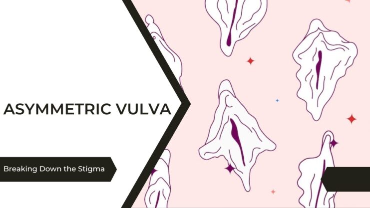 Asymmetric Vulva