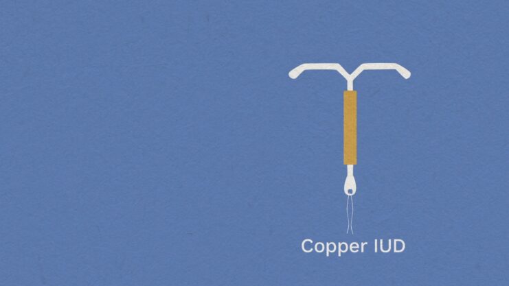 Having an IUD_IUS contraception