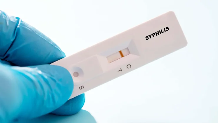 Syphilis Testing