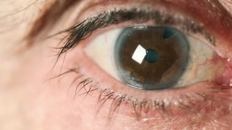 Cataract Symptom