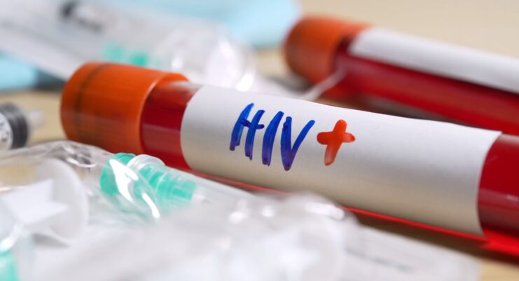 HIV Screening - The First Step to Knowledge