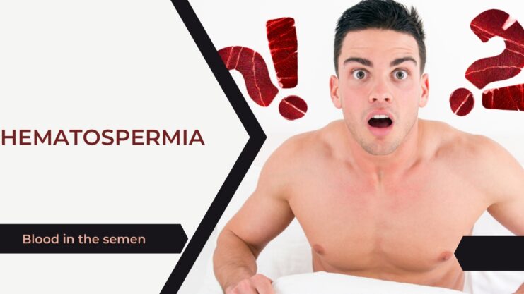 Hematospermia