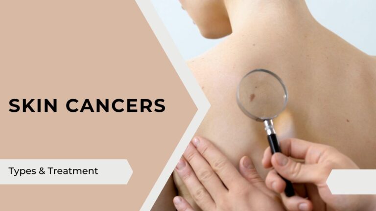 Skin Cancers - types and treatment