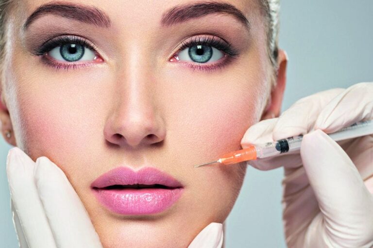 dermal fillers