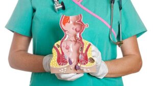 hemorrhoids